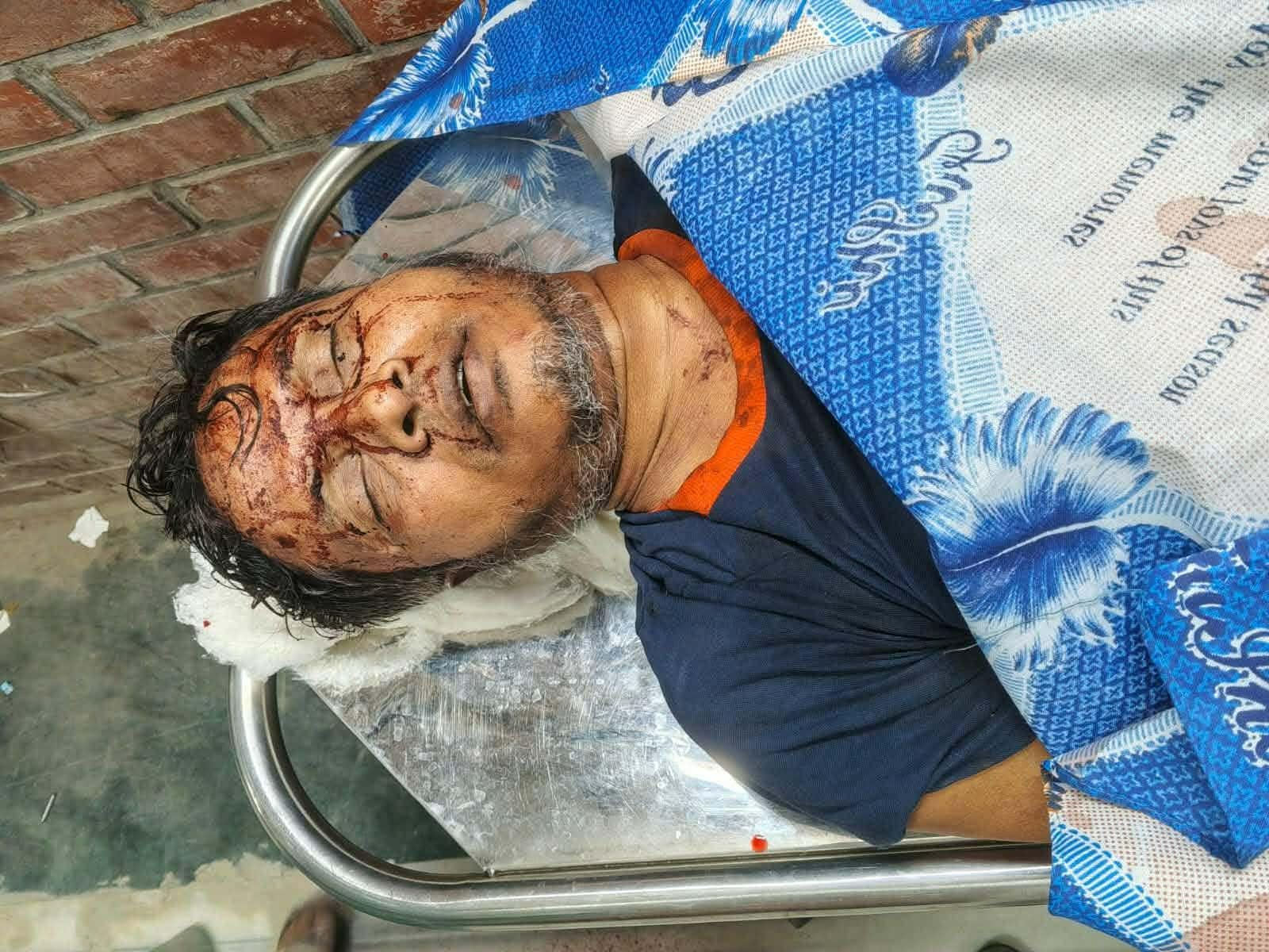 এসবি সদস্যকে পিটিয়ে হত্যা
